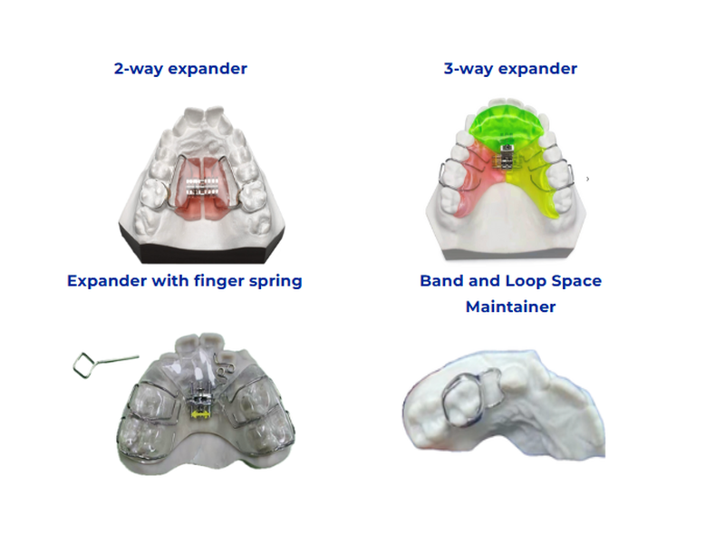 Orthodontic appliances including two-way and three-way expanders, finger-spring expansion device and band-and-loop space maintainer used for pediatric arch development therapy