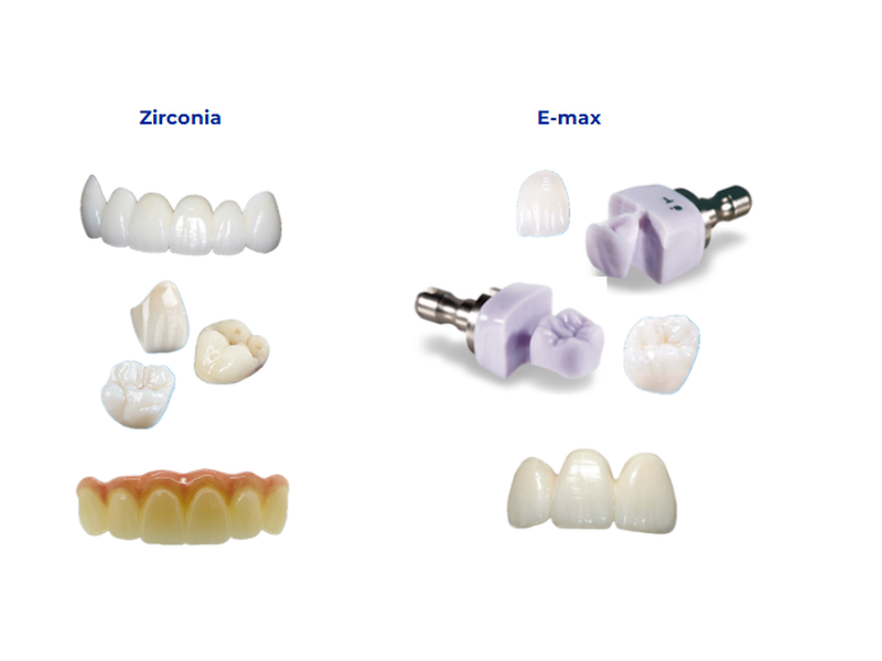 Comparison of zirconia bridges, single crowns and full-arch prostheses versus E-max blocks, veneers and posterior crowns for aesthetic and strength